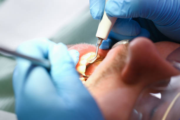Best Emergency Denture Repair in Poughkeepsie, NY